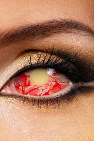 SCLERA PATIENT ZERO DA006