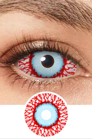 SCLERA BLOOD SHOT INFECTED DA009