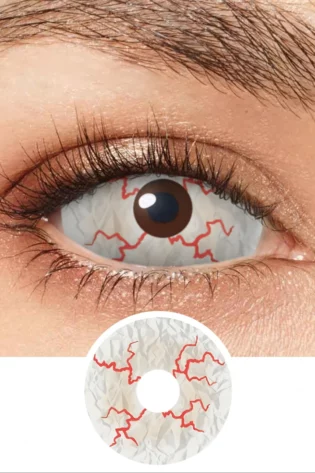 SCLERA BLOOD STRAINED DA10