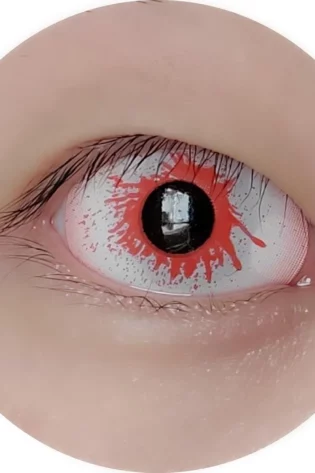 SCLERA BLOOD BURST  DA24